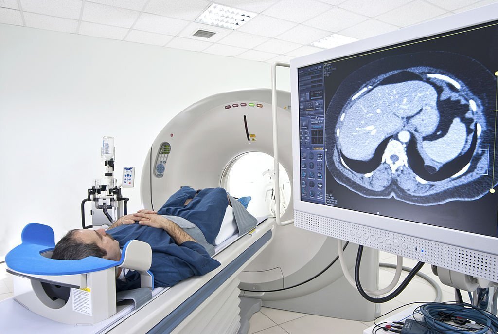 CT scan in Bangalore