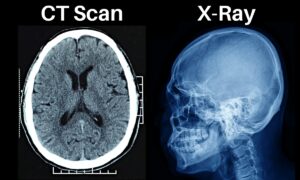 Read more about the article The Difference Between CT Scan And X-Ray