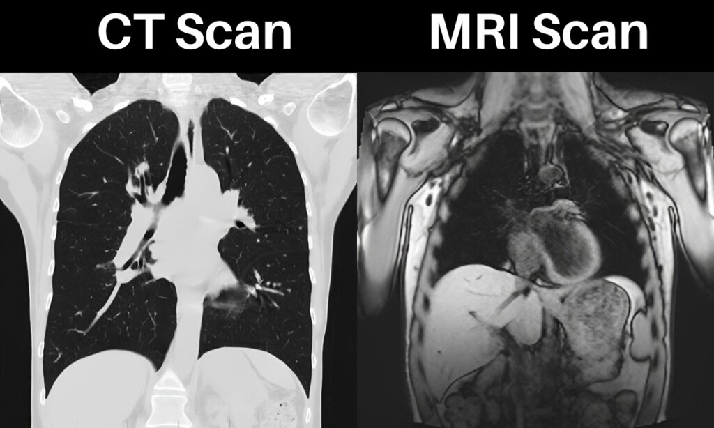 CT Scans VS MRI Scans: What are the Differences Between Them