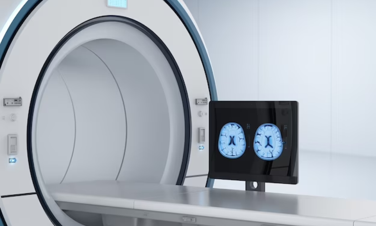 FAPI PET-CT Scans: Unveiling Cancer Imaging’s Future