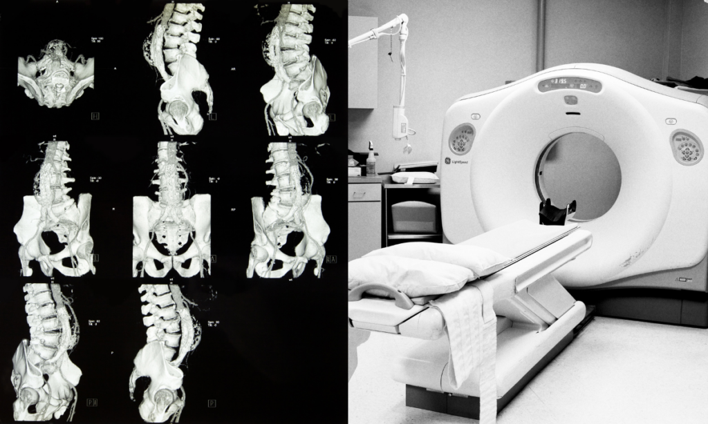 Essential Information on CT Scan for Abdomen and Pelvis