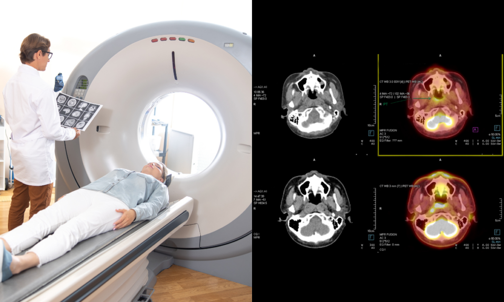 How CT Scans Work and Why They Matter