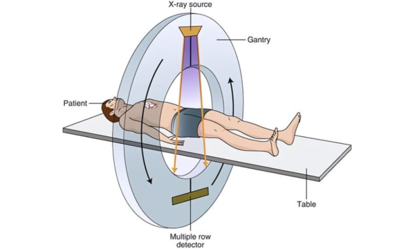 How CT Scans Work and Why They Matter