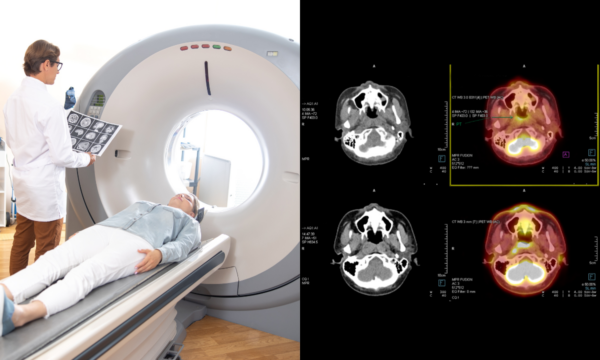 How Ct Scans Work And Why They Matter