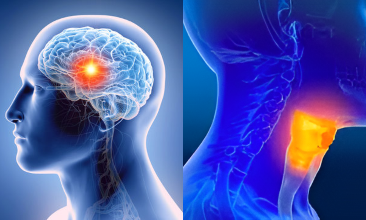 PET Scans to Stage Head and Neck Cancer