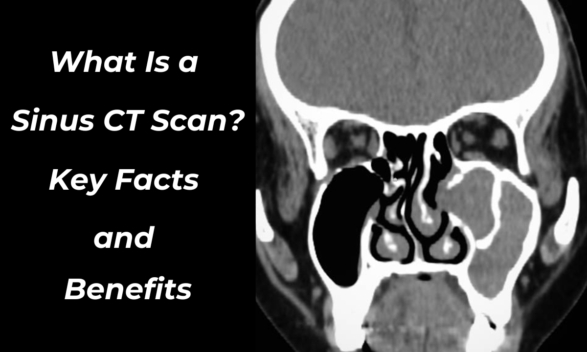 Sinus CT scan