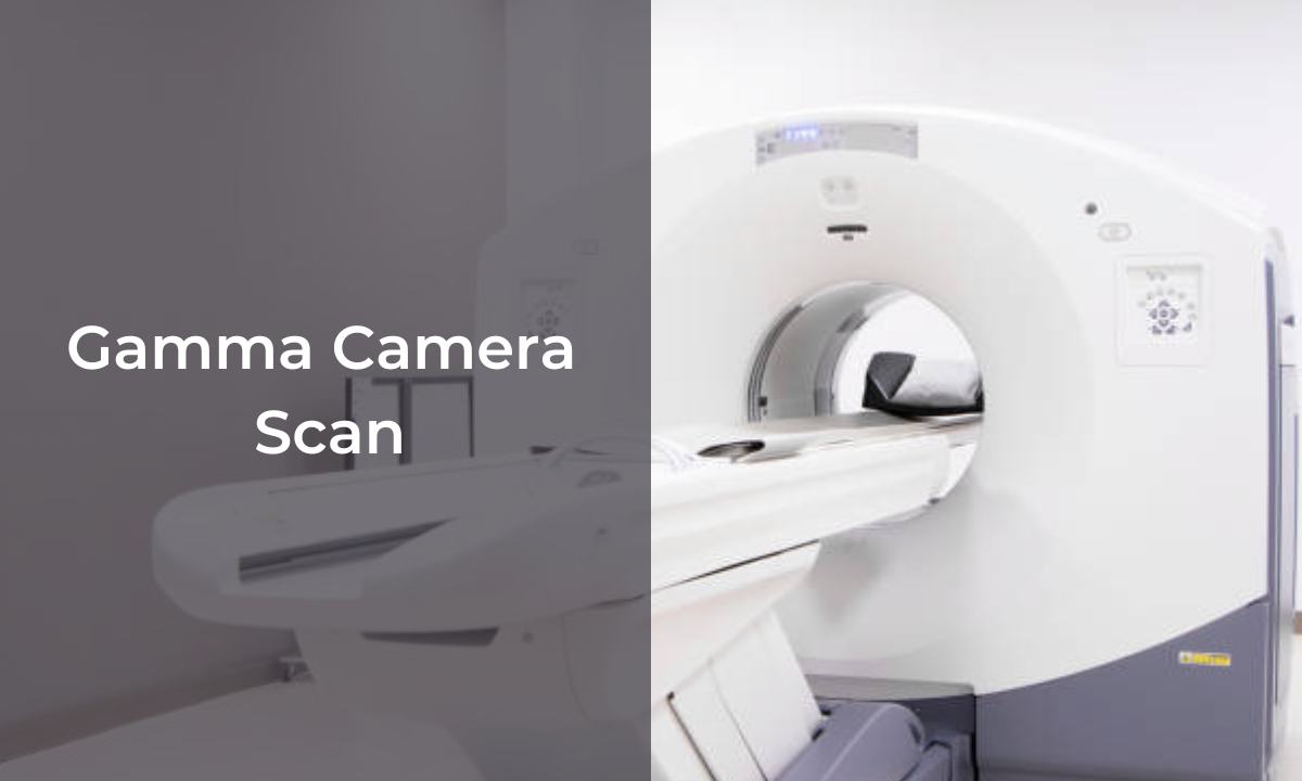 Gamma Camera Scan