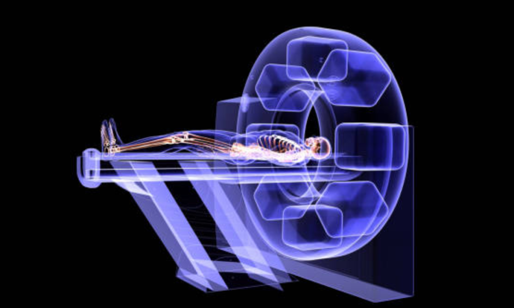 A Complete Guide to Gamma Camera Scans