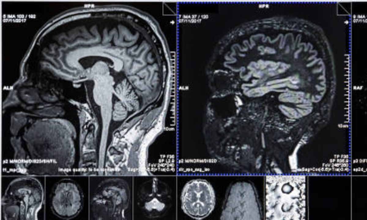 What is a CT aortogram and how does it work?