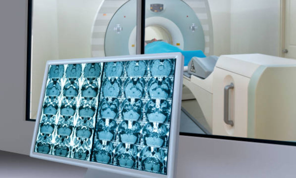 pet ct scan in bangalore