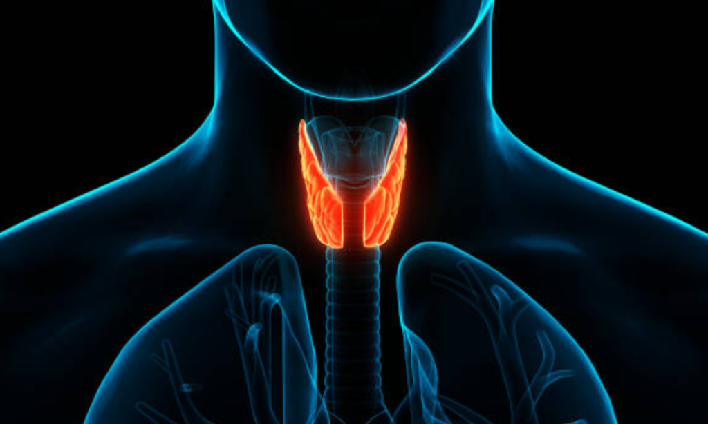 radioactive iodine therapy