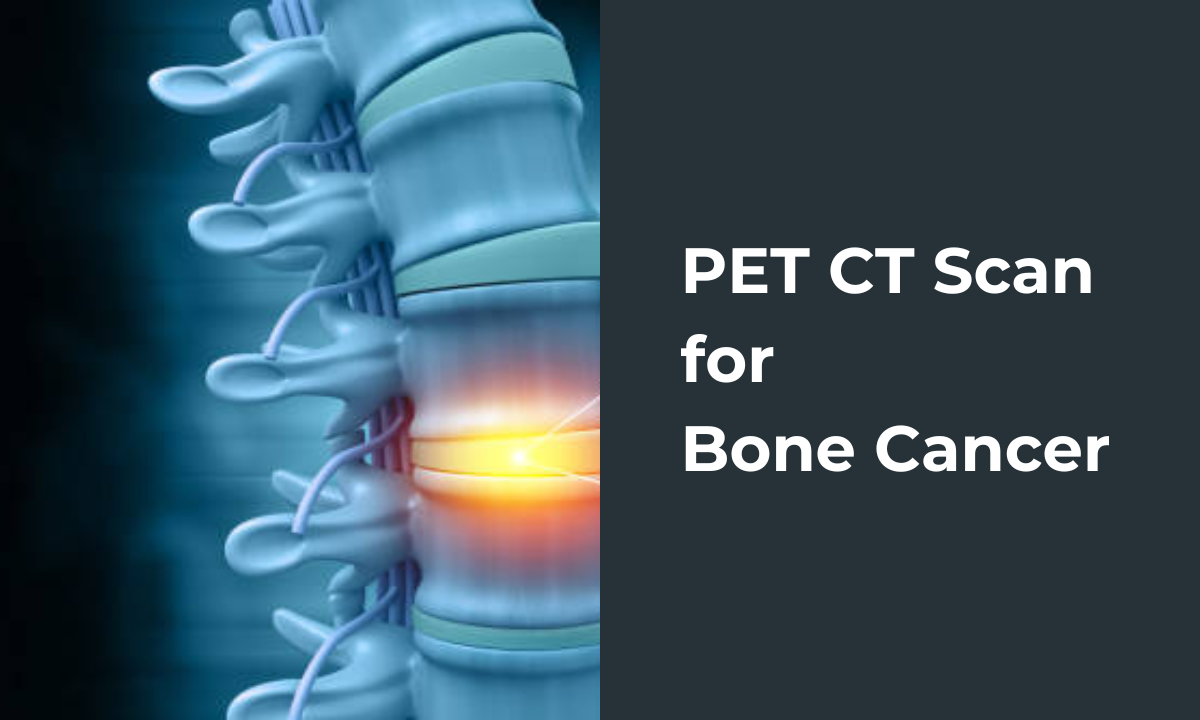 pet ct scan for bone cancer