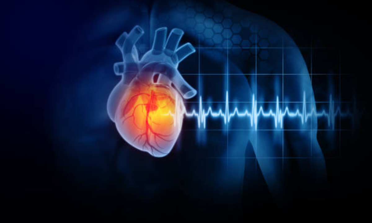 heart ct scan