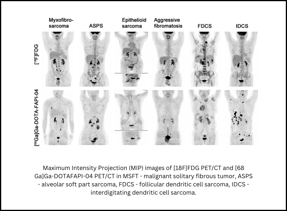 fapi pet ct scan