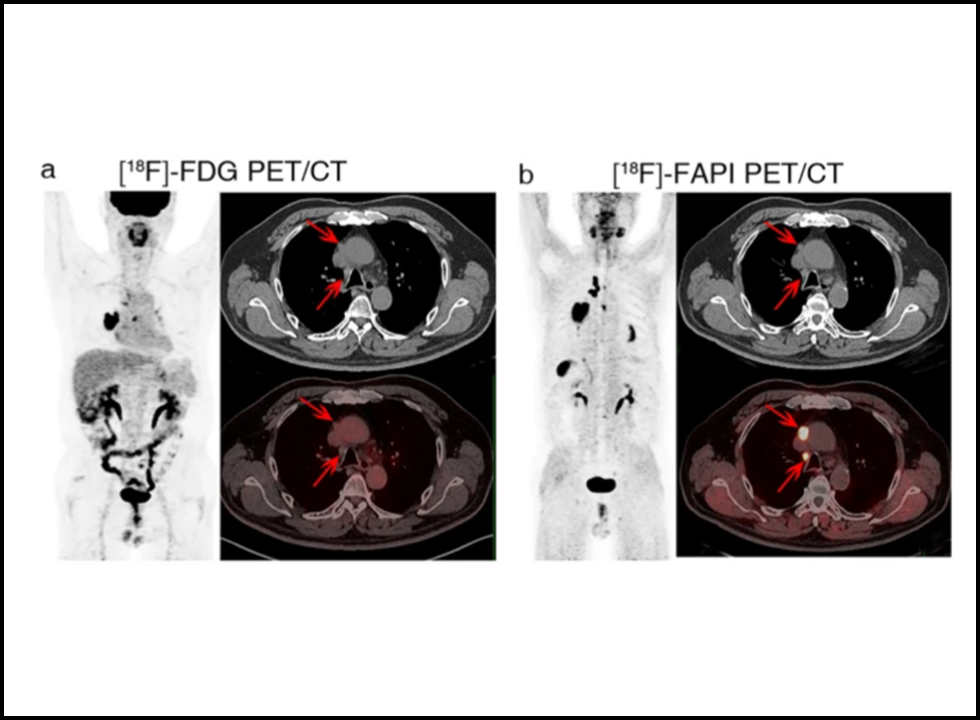 pet ct scan in bangalore