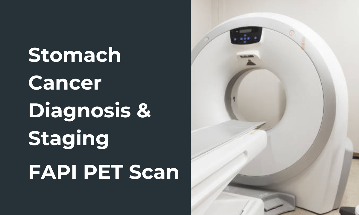 FAPI PET scan for stomach cancer