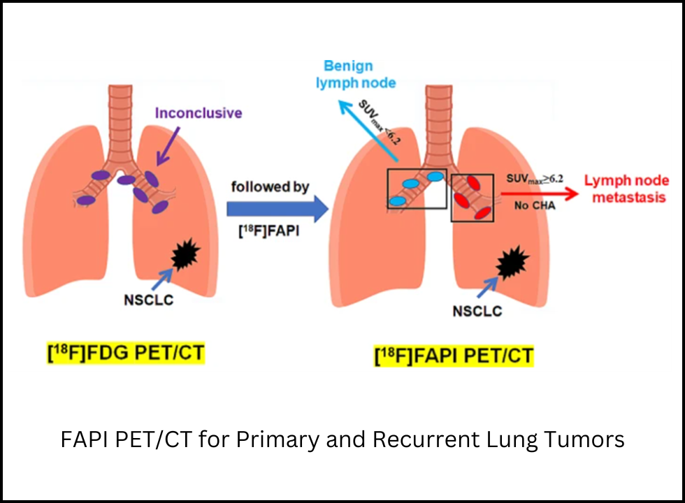 spect scan in bangalore