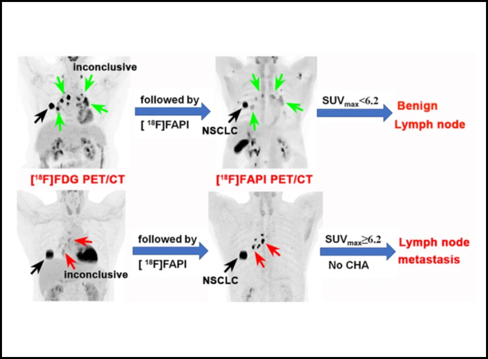 pet scan in bangalore