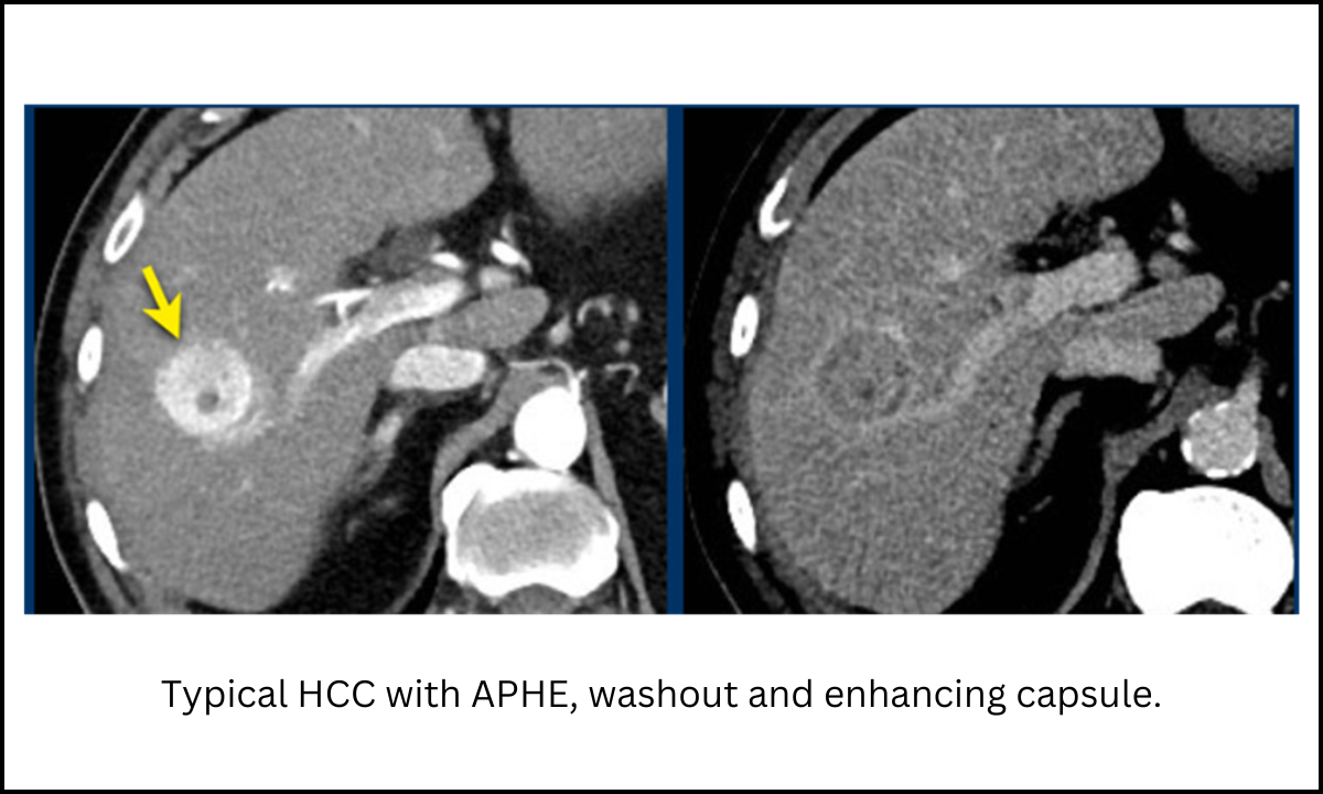 pet ct scan in bangalore