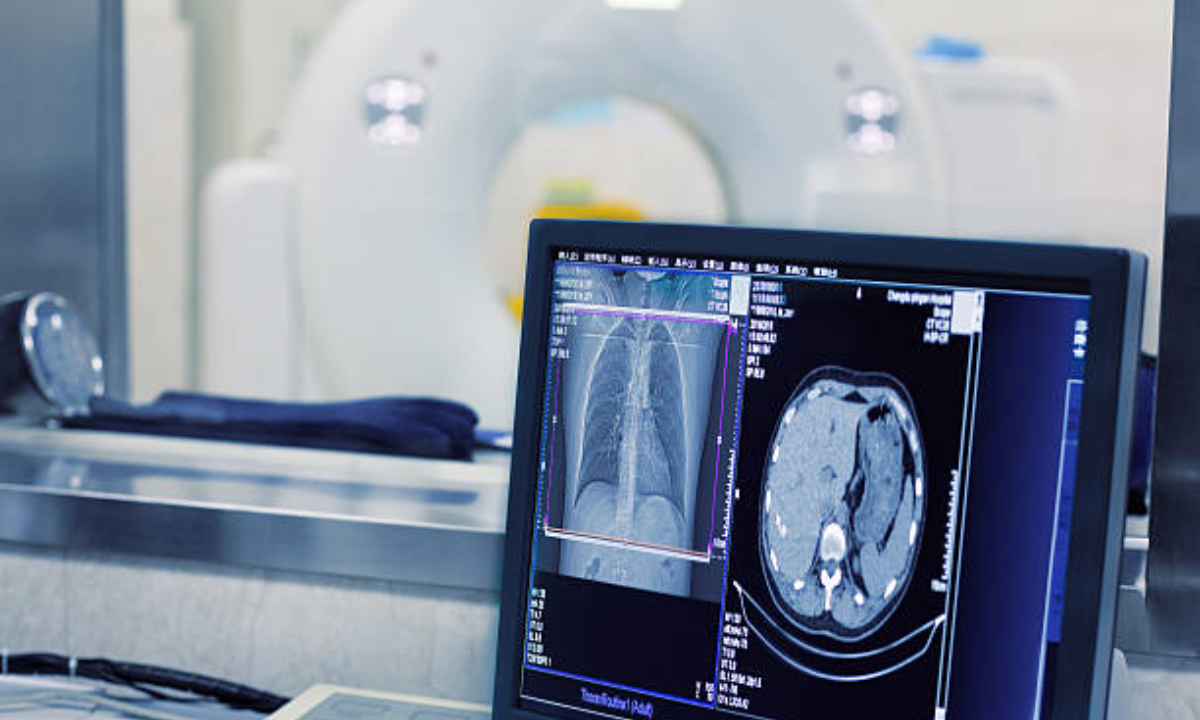 CT scan in Bangalore
