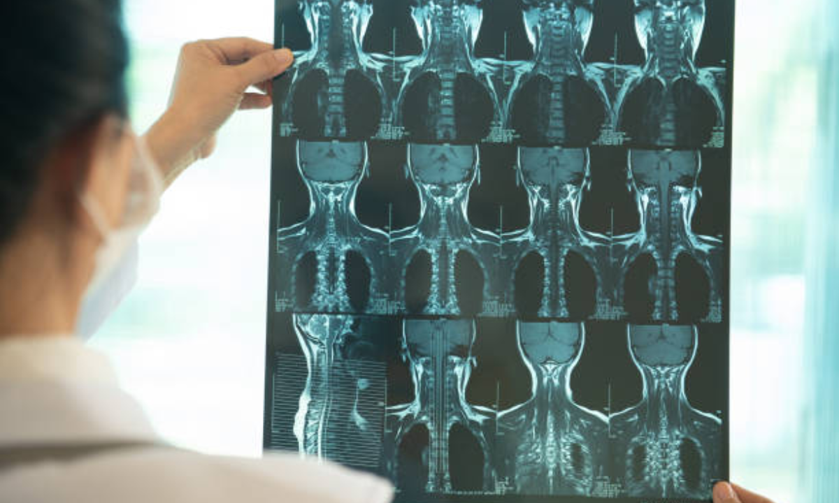Thyroid scan in Bangalore