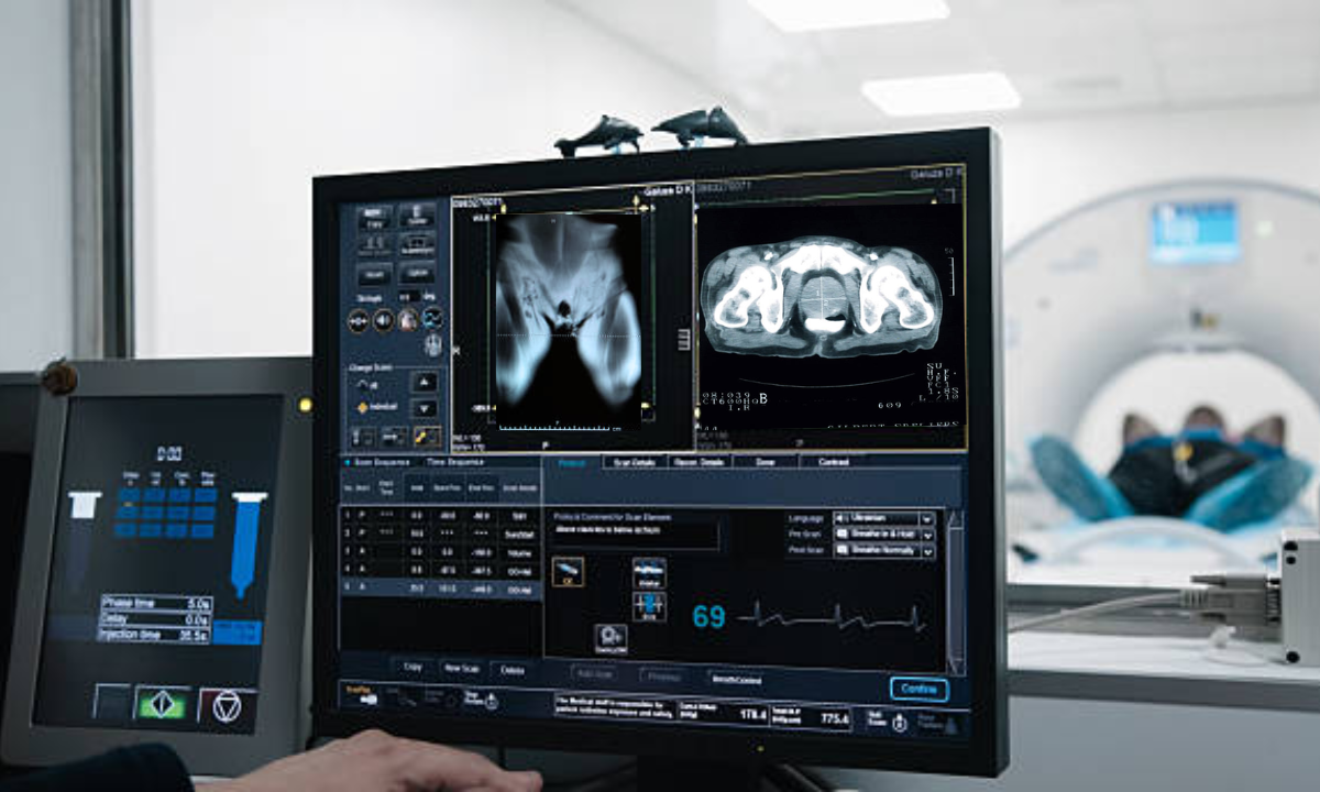 PET CT scan
