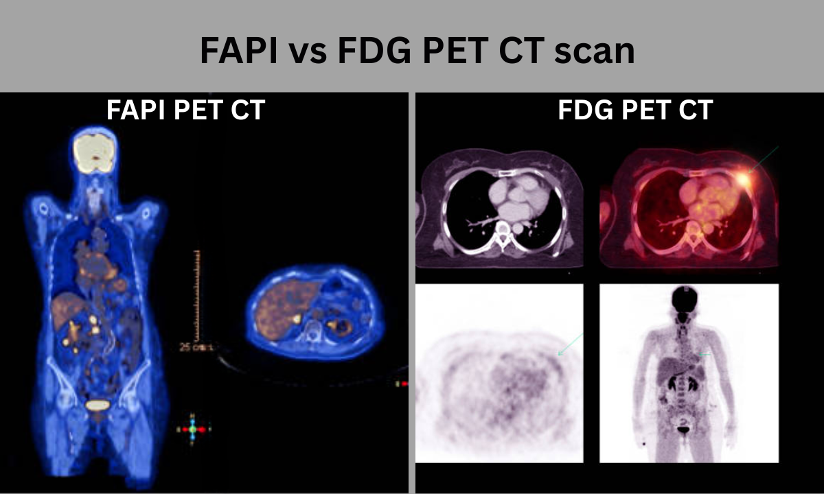 Thyroid scan in Bangalore