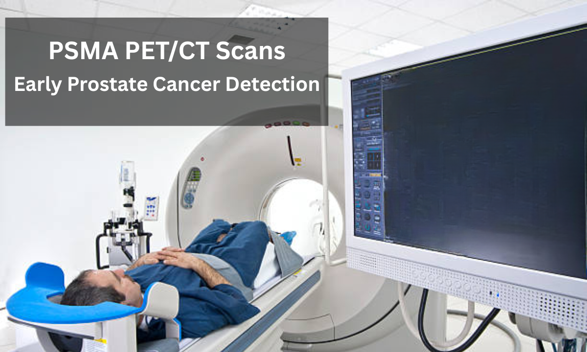 MDP scan in Bangalore