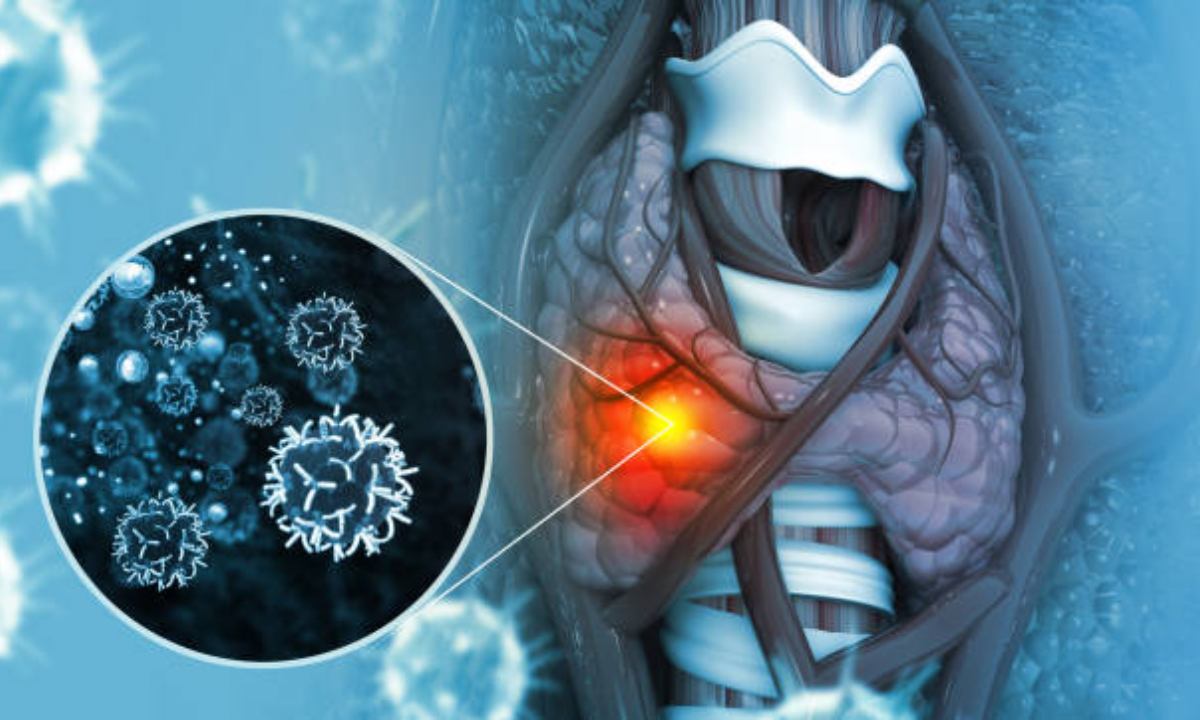 Thyroid scan in Bangalore