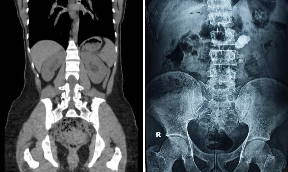 Ct scan in Bangalore