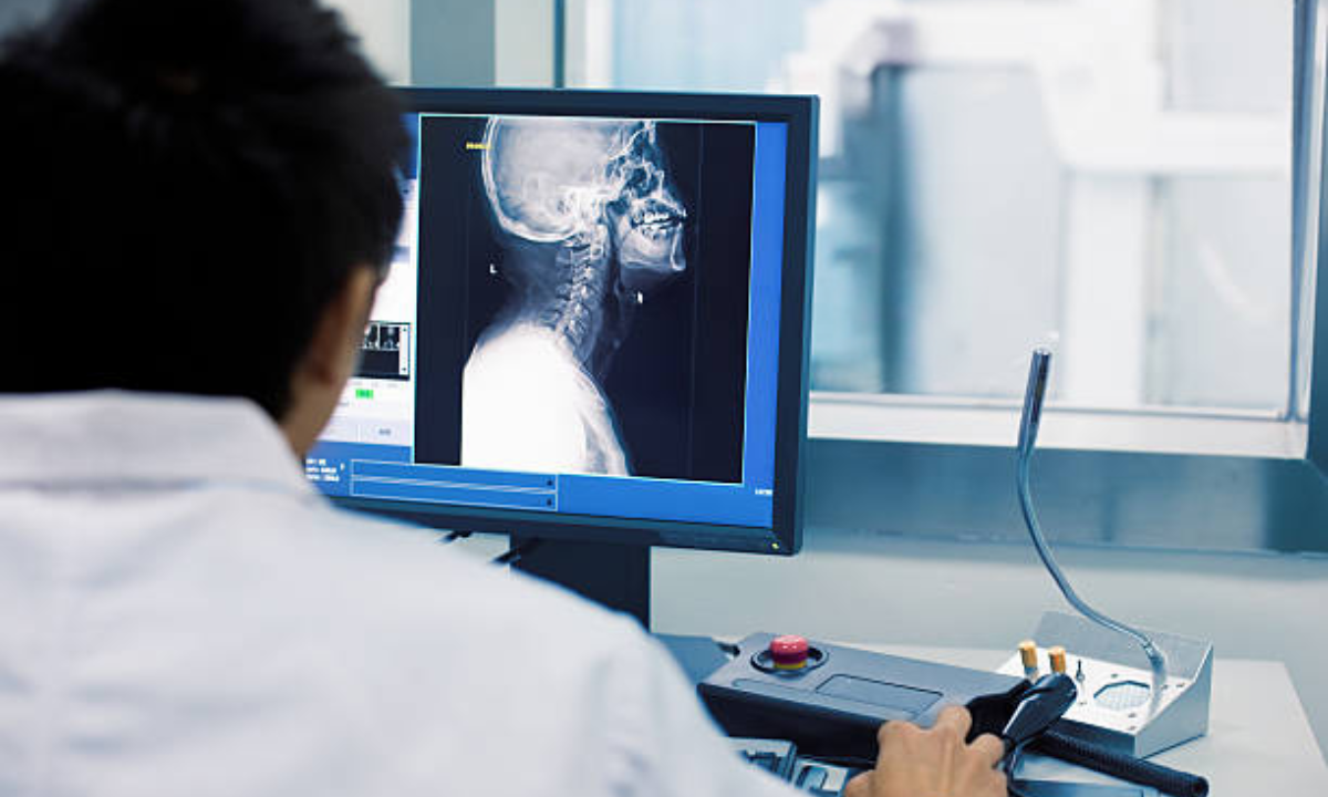 CT scan in Bangalore
