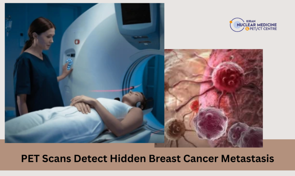 Detecting Hidden Metastasis in Breast Cancer with PET Scan - Kiran Lab
