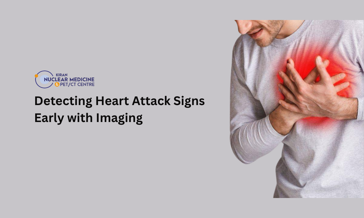Heart attack symptoms