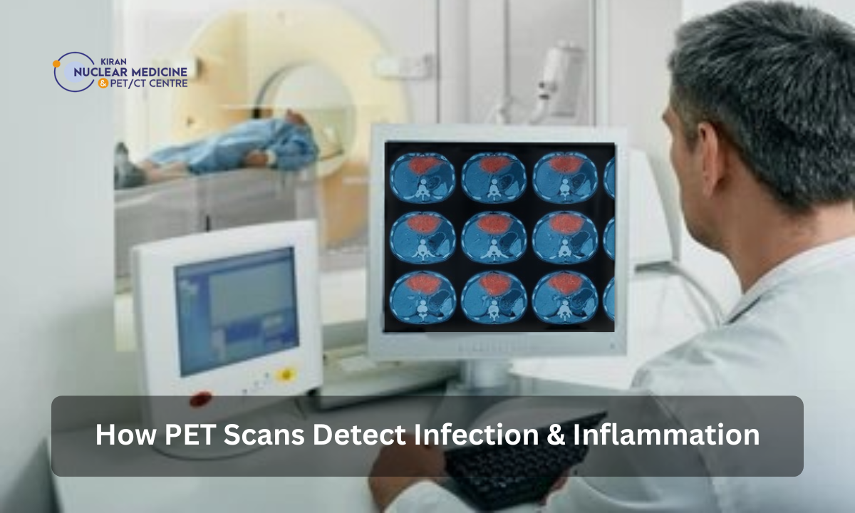 PET scan detect infection