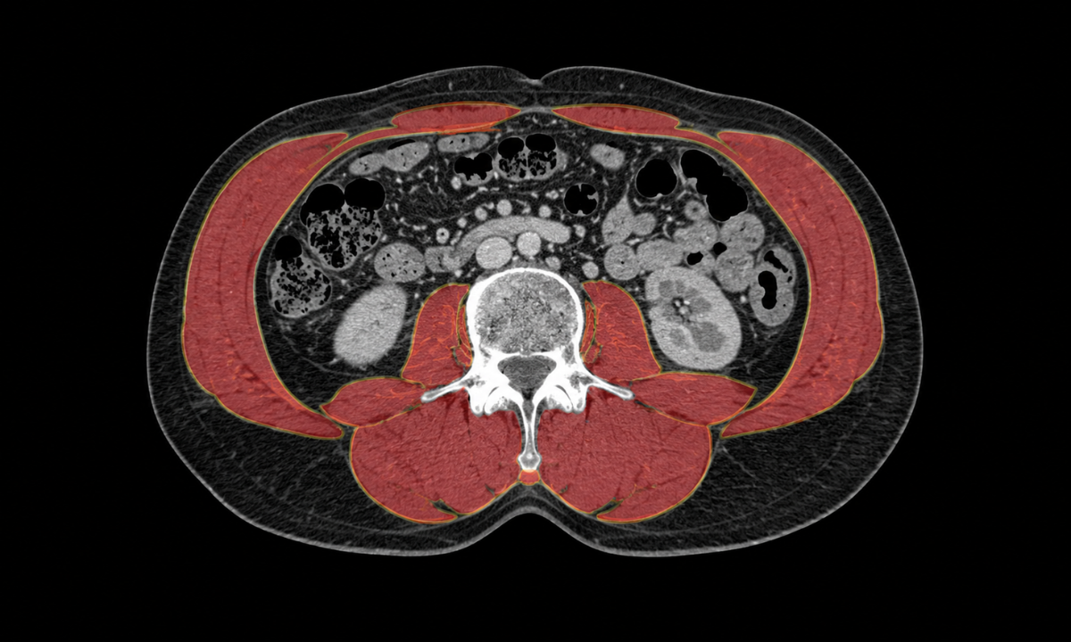 CT imaging and skeletal muscle assessment.